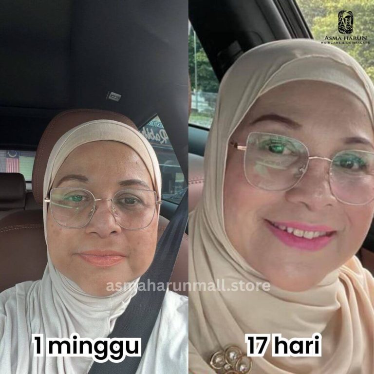 Checkout (Woo) Puan Izzah, 52 Tahun - Rasa smooth tanpa nampak bertapok dan tak berminyak..